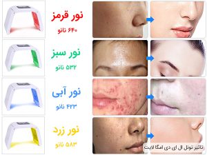 تونل امگا لایت